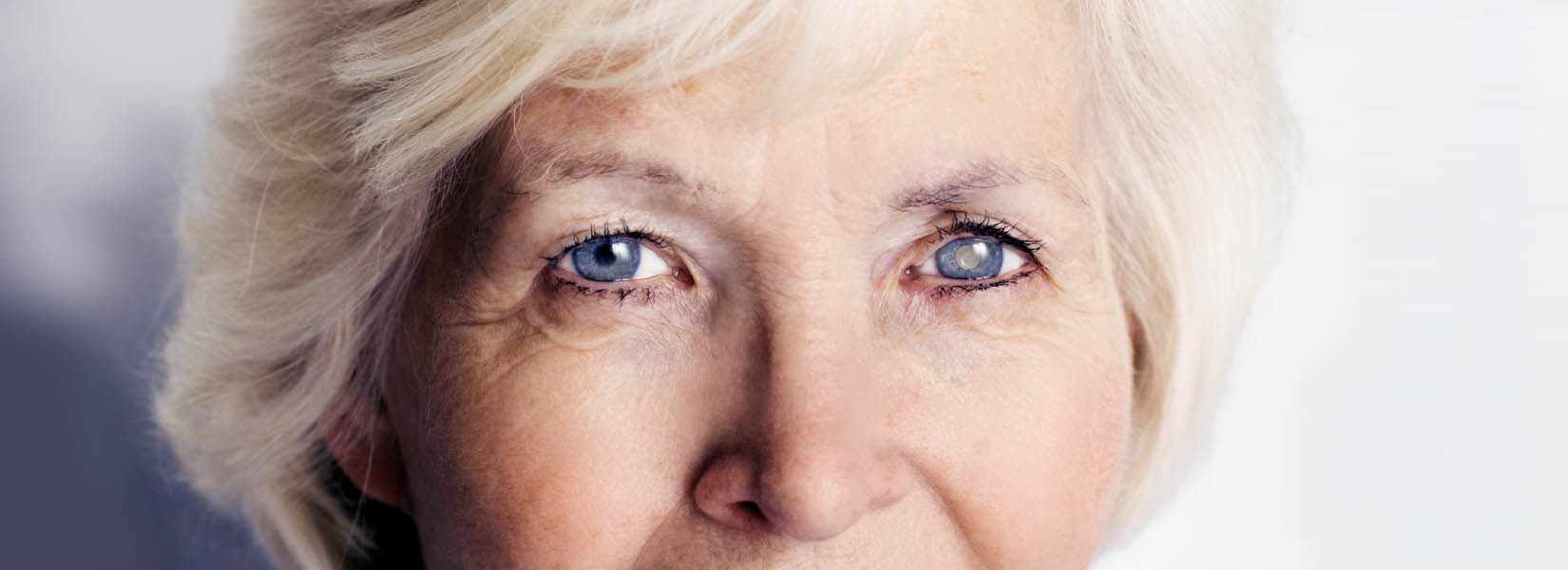 Cataract Surgery in Energy Corridor